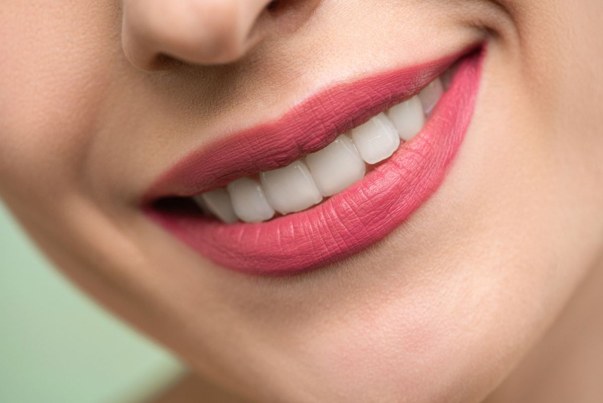 Close-up of a bright, white smile after professional whitening at Maggie A. Kleem, DDS in Berea, Ohio